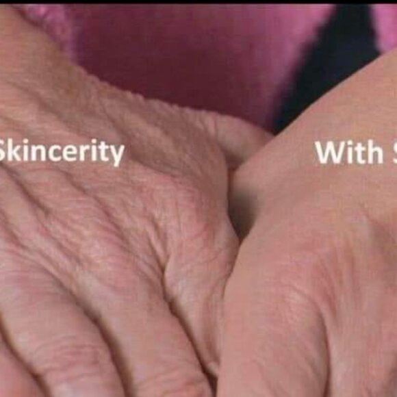 Skincerity - Picture 2 of 6